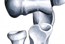 Anatomie des Ellenbogengelenks