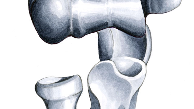 Anatomie des Ellenbogengelenks